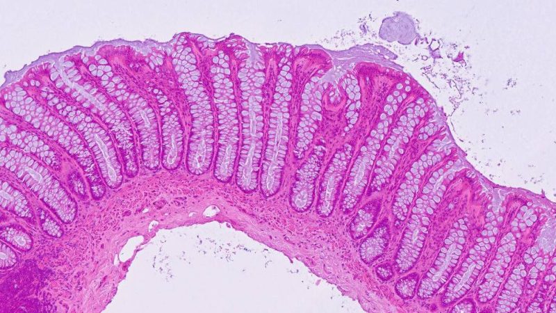 Life Science Index News