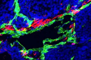 Scientists develop a drug to stop cancers resisting chemotherapy