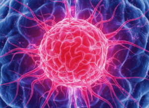 Nogapendekin Alfa Inbakicept Plus NK Cell Therapy Yields Strong OS Signal in Recurrent Glioblastoma